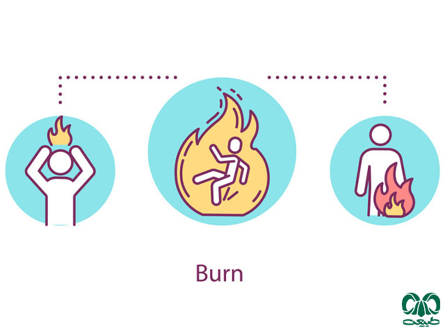 انواع سوختگی‌ها